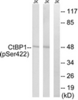 Western blot of extracts from Jurkat cells treated with TNF 20ng/ml 30' and Jurkat cells treated with UV 15', using CtBP1 (Phospho-Ser422) Antibody. The lane on the right was incubated with synthetic peptide.