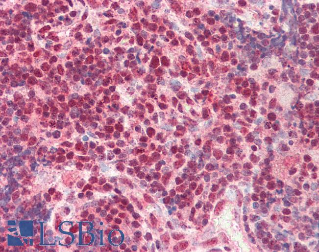 Human, Thymus: Formalin-Fixed Paraffin-Embedded (FFPE)