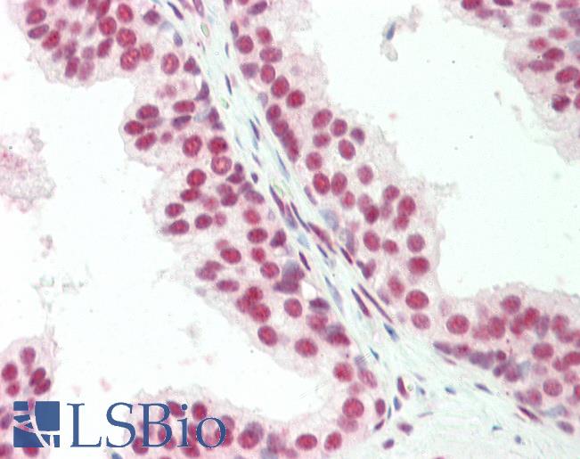 Human, Prostate: Formalin-Fixed Paraffin-Embedded (FFPE)