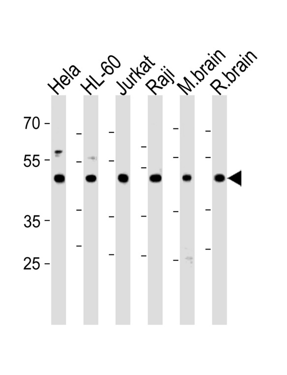 CTBP1 Antibody western blot of HeLa,HL-60,Jurkat,Raji cell line and mouse brain,rat brain tissue lysates (35 ug/lane). The CTBP1 antibody detected the CTBP1 protein (arrow).