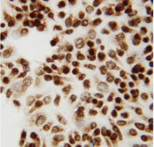 CTBP2 antibody. ICC:HELA Cell.