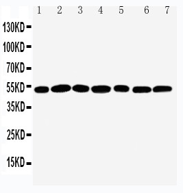 WB of CTBP2 antibody. All lanes: Anti-CTBP2 at 0.5ug/ml. Lane 1: Rat Brain Tissue Lysate at 40ug. Lane 2: Rat Spleen Tissue Lysate at 40ug. Lane 3: HELA Whole Cell Lysate at 40ug. Lane 4: 293T Whole Cell Lysate at 40ug. Lane 5: COLO320 Whole Cell Lysate at 40ug. Lane 6: U87 Whole Cell Lysate at 40ug. Lane 7: SW620 Whole Cell Lysate at 40ug. Predicted bind size: 49KD. Observed bind size: 49KD.