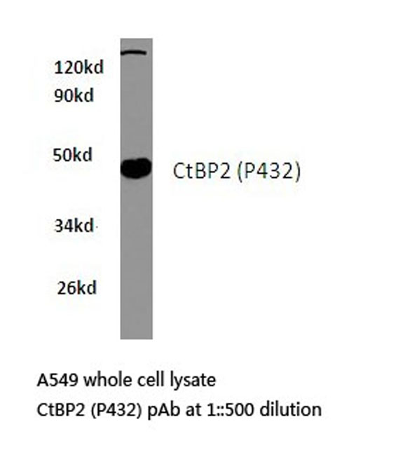 Western blot of CtBP2 (P432) pAb in extracts from A549 cells.