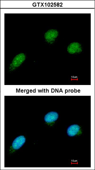 Immunofluorescence of paraformaldehyde-fixed HeLa using CTBP2 antibody at 1:100 dilution.