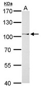 CtBP2 antibody detects CTBP2 protein by Western blot analysis. A. 30 ug A375 whole cell lysate/extract. 7.5 % SDS-PAGE. CtBP2 antibody dilution:1:500