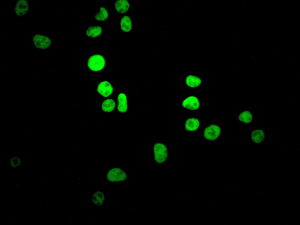 Immunofluorescent staining of SKBR-3 cells using anti-CTBP2 antibody.