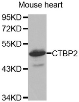 Western blot analysis of extracts of Mouse heart cell line, using CTBP2 antibody.