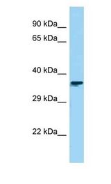 CTBS / CTB antibody Western Blot of HepG2. Antibody dilution: 1 ug/ml.