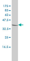 CTBS monoclonal antibody (M01), clone 1B5-1B9 Western Blot analysis of CTBS expression in MCF-7.