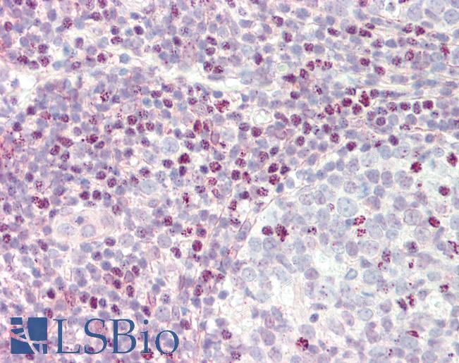 Anti-CTCF antibody IHC staining of human tonsil. Immunohistochemistry of formalin-fixed, paraffin-embedded tissue after heat-induced antigen retrieval. Antibody LS-B10616 concentration 5 ug/ml.