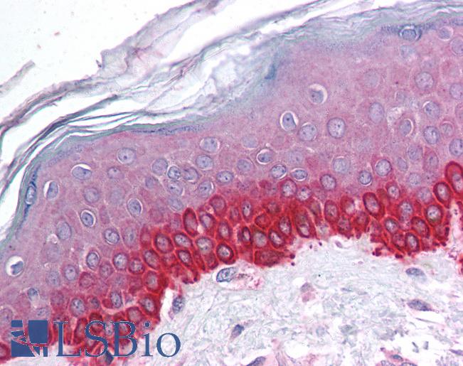 Anti-CTCF antibody IHC of human skin. Immunohistochemistry of formalin-fixed, paraffin-embedded tissue after heat-induced antigen retrieval. Antibody LS-B1518 concentration 5 ug/ml.