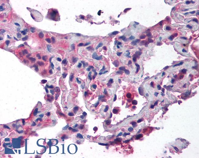 Anti-CTCF antibody IHC of human lung. Immunohistochemistry of formalin-fixed, paraffin-embedded tissue after heat-induced antigen retrieval. Antibody LS-B1518 concentration 5 ug/ml.