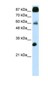 CTCF antibody LS-B1518 Western blot of Transfected 293T cell lysate.