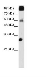 Transfected 293T Cell Lysate