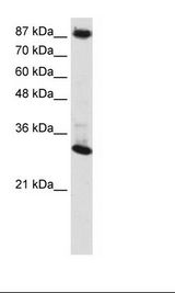 Transfected 293T Cell Lysate
