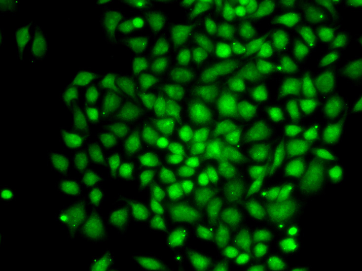 Immunofluorescence analysis of MCF-7 cell using CTCFL antibody. Blue: DAPI for nuclear staining.