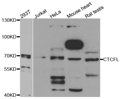 Western blot analysis of extracts of various cell lines, using CTCFL antibody.