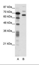 A: Marker, B: Jurkat Cell Lysate