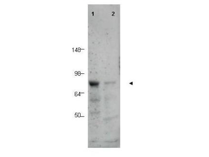Anti-BORIS Antibody - Western Blot. Western blot of Affinity Purified anti-BORIS antibody shows detection of a predominant band corresponding to BORIS in human tissue lysates (arrowhead). Lane 1 contains lysate from human prostate tissue. Lane 2 contains lysate from human spleen tissue. A predominant band at ~75 kD is observed. Molecular weight estimation was made by comparison to prestained MW markers as indicated.