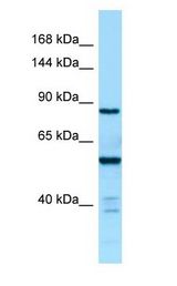 CTDP1 / FCP1 antibody Western Blot of Fetal kidney.