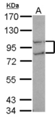 Sample (30 ug of whole cell lysate) A: A549 7.5% SDS PAGE CTDP1 / FCP1 antibody diluted at 1:1000