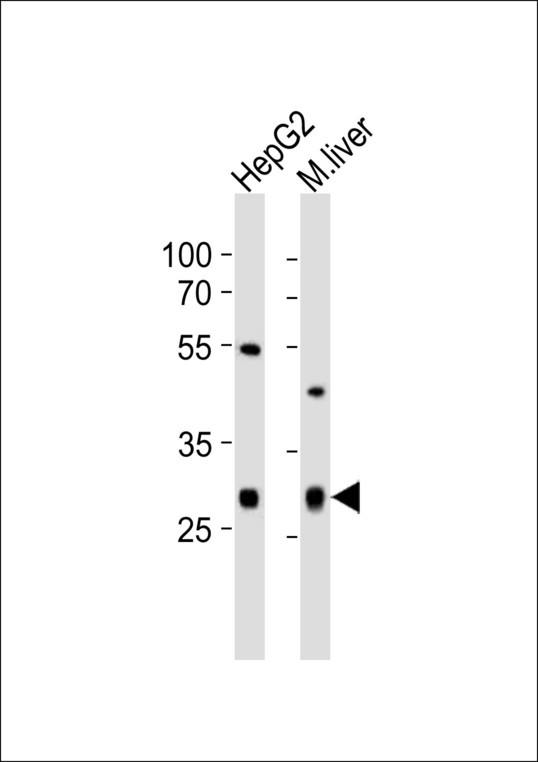Western blot of lysates from HepG2 cell line, mouse liver tissue lysate (from left to right) with CTDSP1 Antibody. Antibody was diluted at 1:1000 at each lane. A goat anti-rabbit IgG H&L (HRP) at 1:10000 dilution was used as the secondary antibody. Lysates at 20 ug per lane.