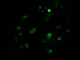 Anti-CTDSP1 mouse monoclonal antibody immunofluorescent staining of COS7 cells transiently transfected by pCMV6-ENTRY CTDSP1.