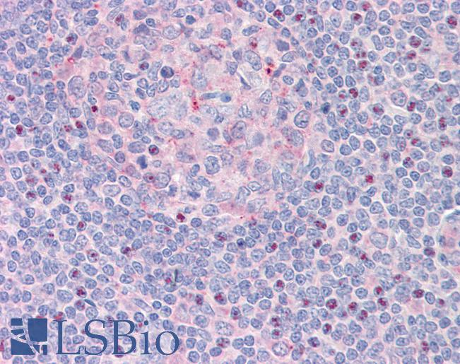Anti-CTDSP1 / SCP1 antibody IHC staining of human tonsil. Immunohistochemistry of formalin-fixed, paraffin-embedded tissue after heat-induced antigen retrieval.