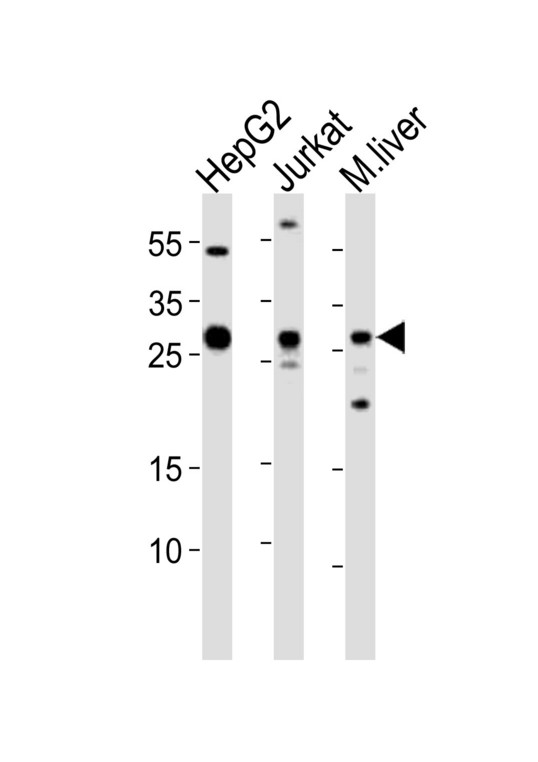 Western blot of lysates from HepG2, Jurkat cell line, mouse liver tissue lysate (from left to right) with CTDSP1 Antibody. Antibody was diluted at 1:1000 at each lane. A goat anti-rabbit IgG H&L (HRP) at 1:10000 dilution was used as the secondary antibody. Lysates at 20 ug per lane.