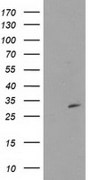 HEK293T cells were transfected with the pCMV6-ENTRY control (Left lane) or pCMV6-ENTRY CTDSP1 (Right lane) cDNA for 48 hrs and lysed. Equivalent amounts of cell lysates (5 ug per lane) were separated by SDS-PAGE and immunoblotted with anti-CTDSP1.