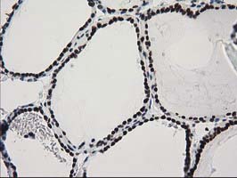 IHC of paraffin-embedded Human thyroid tissue using anti-CTDSP1 mouse monoclonal antibody. (Heat-induced epitope retrieval by 10mM citric buffer, pH6.0, 100C for 10min).