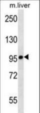 Mouse Chuk Antibody western blot of mouse liver tissue lysates (35 ug/lane). The Chuk antibody detected the Chuk protein (arrow).