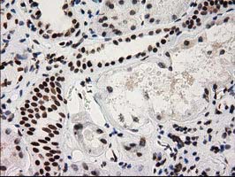 IHC of paraffin-embedded Human Kidney tissue using anti-CTDSP1 mouse monoclonal antibody. (Heat-induced epitope retrieval by 10mM citric buffer, pH6.0, 100C for 10min).