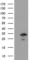 HEK293T cells were transfected with the pCMV6-ENTRY control (Left lane) or pCMV6-ENTRY CTDSP1 (Right lane) cDNA for 48 hrs and lysed. Equivalent amounts of cell lysates (5 ug per lane) were separated by SDS-PAGE and immunoblotted with anti-CTDSP1.