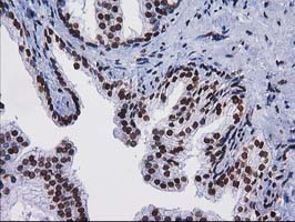 IHC of paraffin-embedded Human prostate tissue using anti-CTDSP1 mouse monoclonal antibody.