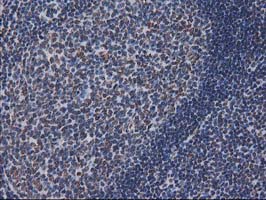 IHC of paraffin-embedded Human lymph node tissue using anti-CTDSP1 mouse monoclonal antibody.