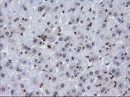 IHC of paraffin-embedded Human liver tissue using anti-CTDSP1 mouse monoclonal antibody.