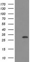HEK293T cells were transfected with the pCMV6-ENTRY control (Left lane) or pCMV6-ENTRY CTDSP1 (Right lane) cDNA for 48 hrs and lysed. Equivalent amounts of cell lysates (5 ug per lane) were separated by SDS-PAGE and immunoblotted with anti-CTDSP1.