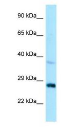 CTDSP1 / SCP1 antibody Western Blot of HepG2.