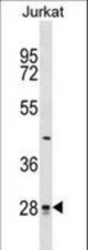 CTDSP1 Antibody western blot of Jurkat cell line lysates (35 ug/lane). The CTDSP1 antibody detected the CTDSP1 protein (arrow).
