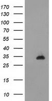 HEK293T cells were transfected with the pCMV6-ENTRY control (Left lane) or pCMV6-ENTRY CTDSP1 (Right lane) cDNA for 48 hrs and lysed. Equivalent amounts of cell lysates (5 ug per lane) were separated by SDS-PAGE and immunoblotted with anti-CTDSP1.
