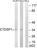 Western blot of extracts from HeLa/HUVEC cells, using CTDSP1 Antibody. The lane on the right is treated with the synthesized peptide.