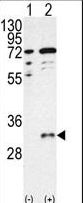 Western blot of CTDSP1 (arrow) using CTDSP1-V250 Antibody. 293 cell lysates (2 ug/lane) either nontransfected (Lane 1) or transiently transfected with the CTDSP1 gene (Lane 2) (Origene Technologies).