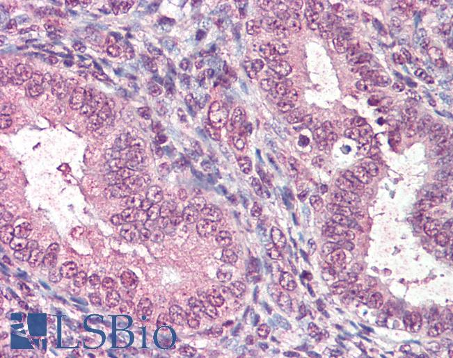 Anti-CTDSP1 antibody IHC of human uterus. Immunohistochemistry of formalin-fixed, paraffin-embedded tissue after heat-induced antigen retrieval. Antibody LS-B7228 concentration 5 ug/ml.
