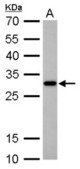CTDSP2 antibody detects CTDSP2 protein by Western blot analysis. A. 30 ug PC-12 whole cell lysate/extract. 12 % SDS-PAGE. CTDSP2 antibody dilution:1:1000
