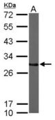 Sample (50 ug of whole cell lysate). A: Mouse brain. 12% SDS PAGE. CTDSP2 antibody diluted at 1:1000.