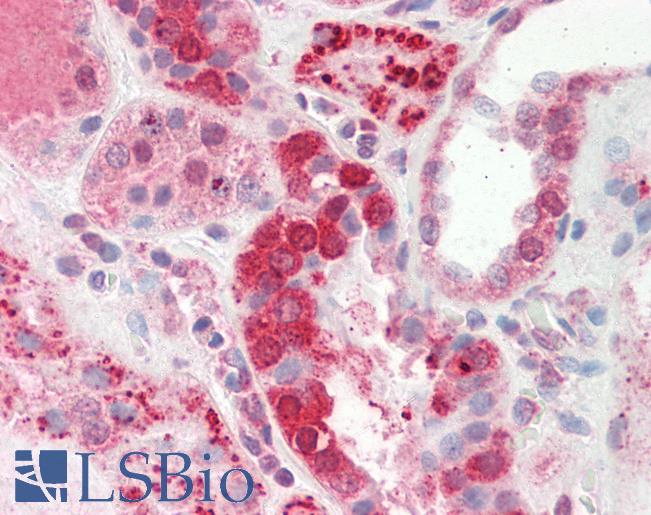 Human Kidney: Formalin-Fixed, Paraffin-Embedded (FFPE)