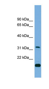 CTDSP2 antibody western blot of RPMI-8226 cell lysate.