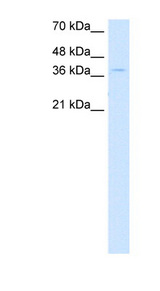 CTDSPL antibody LS-C40376 Western blot of DLD1 cell lysate.