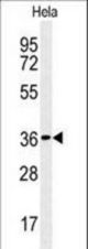 CTDSPL Antibody western blot of HeLa cell line lysates (35 ug/lane). The CTDSPL antibody detected the CTDSPL protein (arrow).